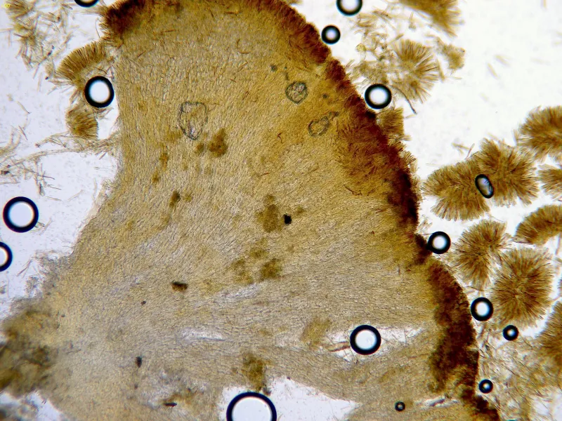 Calycina vulgaris 16 - Pared x 100 Lugol-001